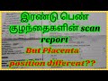 #girl/pregnancy scan report forgirl baby/Placenta anterior or posterior/Girlbaby scan detailsintamil