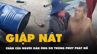 Cắt thùng phuy phát nổ, người đàn ông 58 tuổi giập nát cả chân