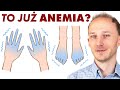 Czy to już anemia? Wczesne objawy anemii: 13 oznak, że warto się zbadać | Dr Bartek Kulczyński