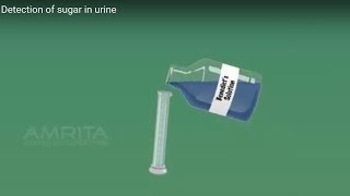 Detection of Sugar in Urine - MeitY OLabs