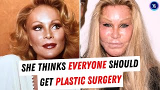 Jocelyn "Catwoman" Wildenstein: Plastic Surgery's Biggest Fan