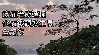 癌症|化療|甩頭髮|光頭|治療記錄|化療後頭髮生長|電療|化療副作用|甩眼眉毛|甩眼睫毛|乳癌