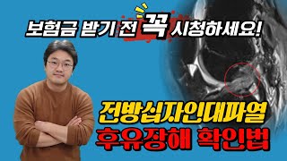 전방십자인대 파열 후유장해보험금 미리 포기하지 마세요!