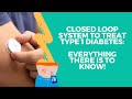 Closed Loop System to treat Type 1 Diabetes: Everything there is to know!