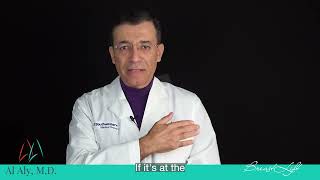 Dr. Aly explains Mastopexy or Breast Lift