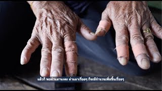 สารเคมีในการเกษตร : เอาข้อเท็จจริงจากไร่นาเข้าไปอยู่ในสภาให้ได้