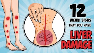 Warning: 12 Weird Signs That Show You're Having LIVER DAMAGE