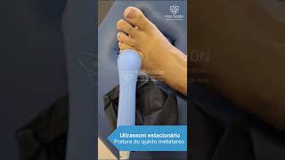 Tratamento conservador de fratura #fisioterapia #saude #sports #shorts