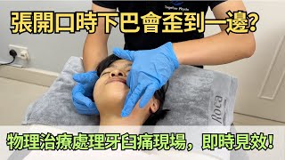 牙骹痛治療現場: 每次張開口時下巴都會歪向一邊? 物理治療示範如何處理牙臼痛問題，即時見效｜吳子謙物理治療師｜凝聚物理治療中心 Together Physio