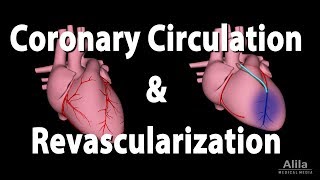 Coronary Circulation and Revascularization, Animation