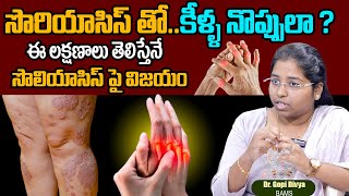 Psoriatic Arthritis Treatment In Telugu | RK Ayurvedic Psoriasis Centre | Dr. Gopi Divya | SumanTv