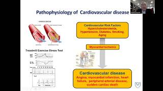 Diagnosis & Management of Coronary Artery Disease