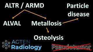 Hip Metallosis, Pseudotumor, ALVAL or ALTR or ARMD?