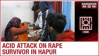 Hapur: Rape survivor attacked with acid, victim admitted to a hospital