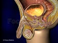 urodynamic assessment animated atlas of bph and oab