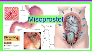 misoprostol