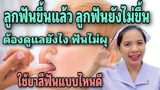 ลูกฟันขึ้นแล้ว ลูกฟันไม่ขึ้นต้องดูแลยังไง ฟันไม่ผุ ต้องใช้ยาสีฟันแบบไหน