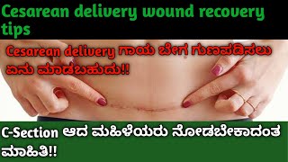 Cesarean delivery ಗಾಯ ಬೇಗ ಗುಣಪಡಿಸಲು ಏನು ಮಾಡಬಹುದು!! Cesarean delivery wound recovery tips in kannada!