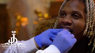 Lil Durk Gets Permanent Grill Done by Johnny Dang Himself + Discusses when YNW Melly gets out?!?!