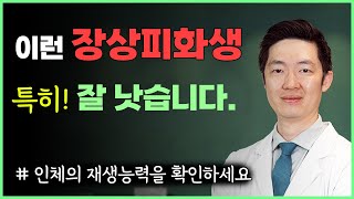 이런 장상피화생, 특히 잘 치료됩니다