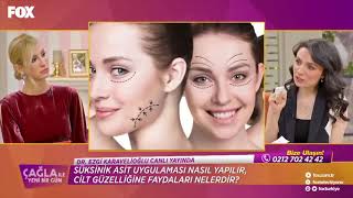 Dr  Ezgi Karavelioğlu; Süksinik Asit ve Mezoterapi   / Çağla İle Yeni Bir Gün - FOX Tv