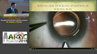 AIOC2018 - IC027 - Topic - Managing post operative refractive surprises. By Dr.Kumar J Doctor