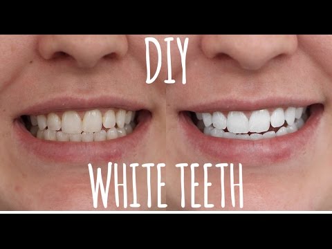 HOW TO WHITEN SMOKERS TEETH HOW TO WHITEN SMOKERS TEETH