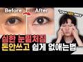 눈밑처짐 돈안쓰고 없애는법 | 홈케어부터 시술까지 총정리!