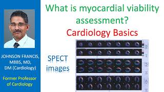 What is myocardial viability assessment? Cardiology Basics