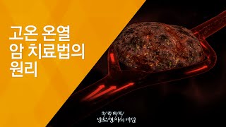 고온 온열 암 치료법의 원리 - (2010.2.4_320회 방송)_열이 몸을 살린다, 체온면역