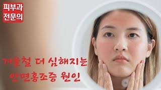 찬바람 불면 더 빨개지는 🥵안면홍조증 원인