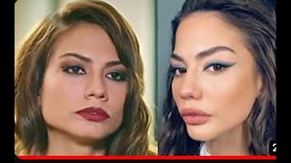 Demet Ozdemir Before and After Plastic Surgery  - Demet's Version