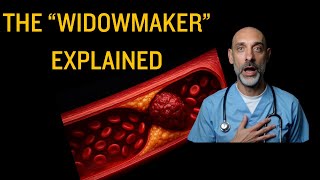 Heart Attack Explained
