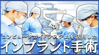 インプラント手術　下の奥歯　コンピュータガイドシステムによる実際の手術の様子　#ガイデッドサージェリー　#インプラント　#歯医者　#implant　#guidedsurgery