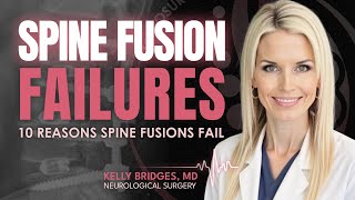 10 Most Common Reasons Spine Fusions FAIL and How to Avoid Them