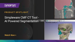 Simpleware CMF CT Tool - AI-Powered Segmentation | Synopsys