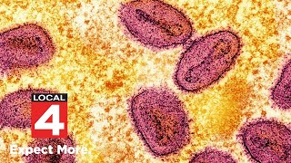 FBI: NIH scientists accused of smuggling monkeypox into US through Detroit Metro Airport