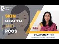 PCOS & Skin Problems - Best Dermatologist Treatment for #pcos - Dr. Arundathi N | Doctors' Circle