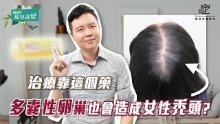 多囊性卵巢也與女性雄性禿有關！該如何治療？｜謝宗廷醫師