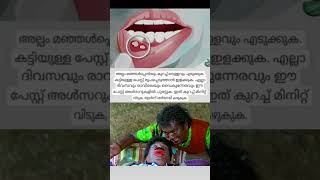 ഈ വേദന വന്നവർ ഉണ്ടോ?#viralvideo #fyp