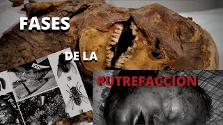 Fases de la putrefacción humana - signos tardíos | Fenómenos Cadavéricos | Forenses Investigadores