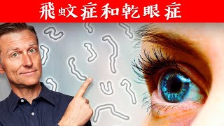 (眼睛)飛蚊症和乾眼症,自然療法,柏格醫生 Dr Berg