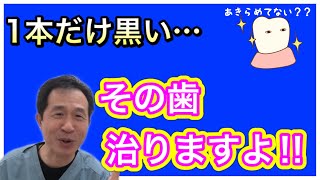 【ホワイトニング】 1本だけ黒い歯、歯科医院でしかできない技術、すべてみせます！