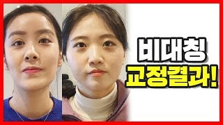 깜짝놀란 비대칭 개선 마사지 10회 결과를 공개합니다!!