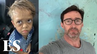 Quaden Bayles: Actor Hugh Jackman has sent a message of public support to the Australian boy