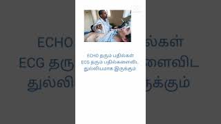 #echo heart test#shorts #tamil