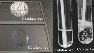 Catalase test