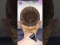 asmr giant hardened flakes dandruff removal at hairline scalp treatment animation asmr viral