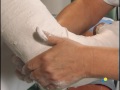 applying an above elbow circular cast