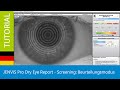 JENVIS Pro Dry Eye Report - Screening: Beurteilungsmodus